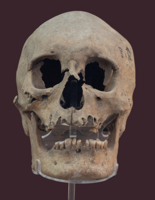 Cráneo y mandíbula
